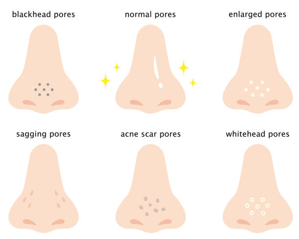 clogged pores before and after