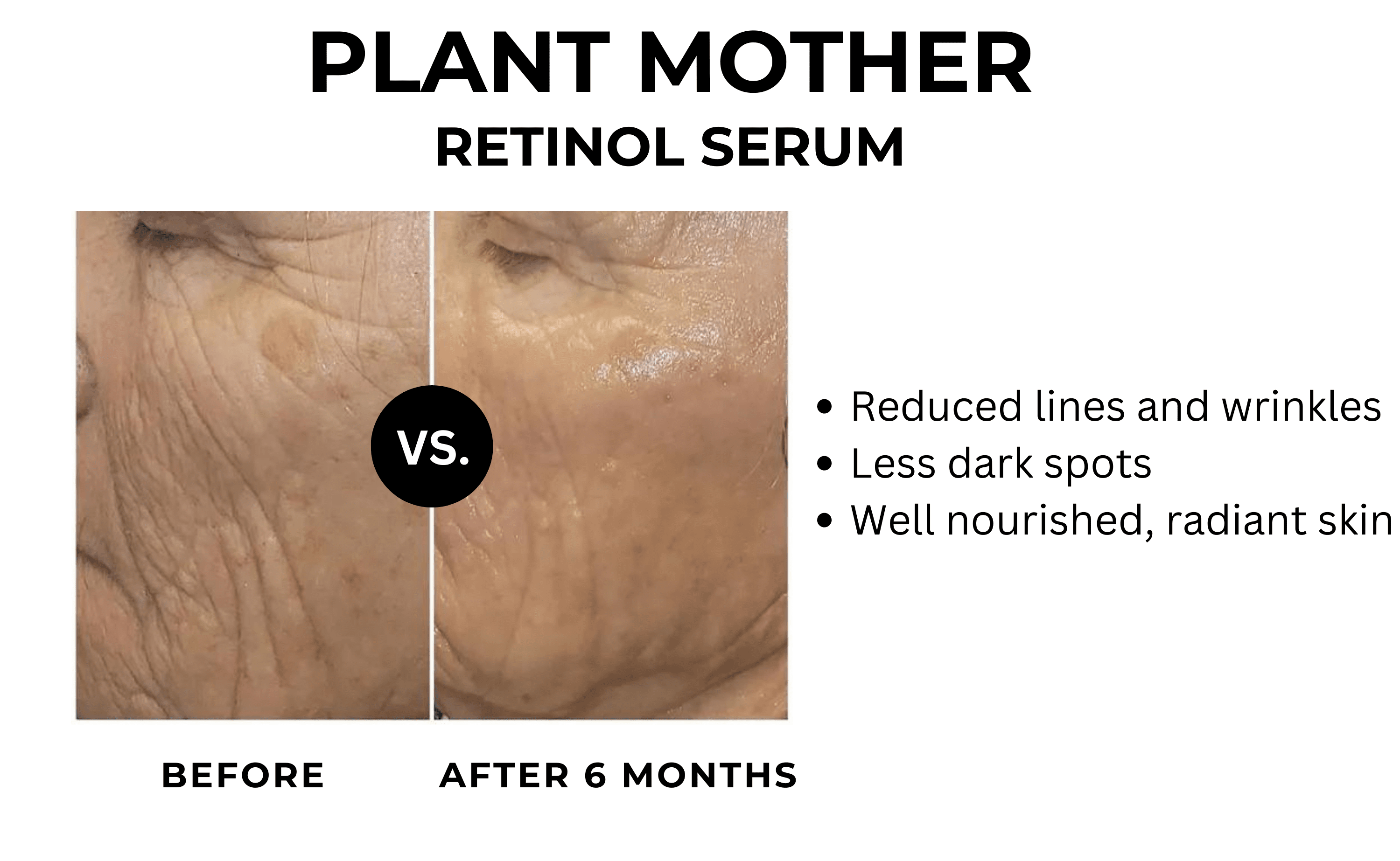 Vitamin C + Retinol Plant Mother