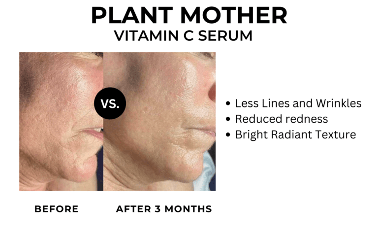 vitamin c serum before and after