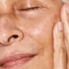 niacinamide