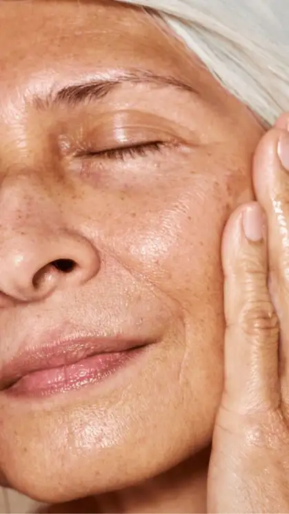 niacinamide