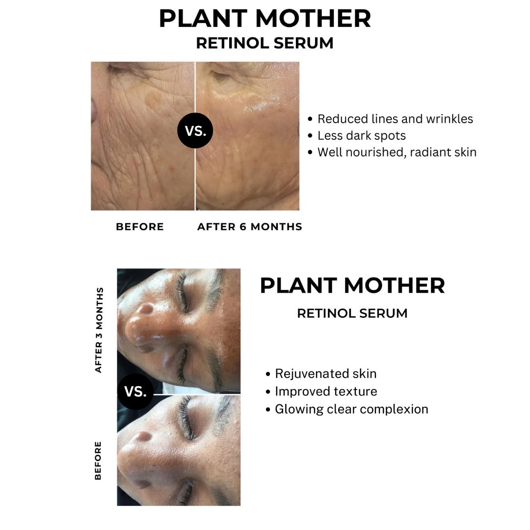 retinol before and after