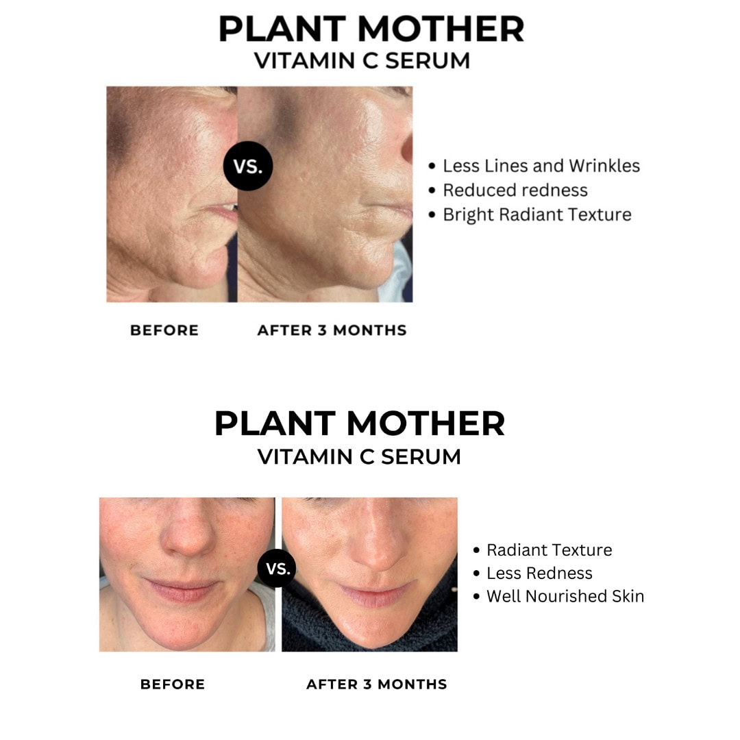 vitamin c before and after