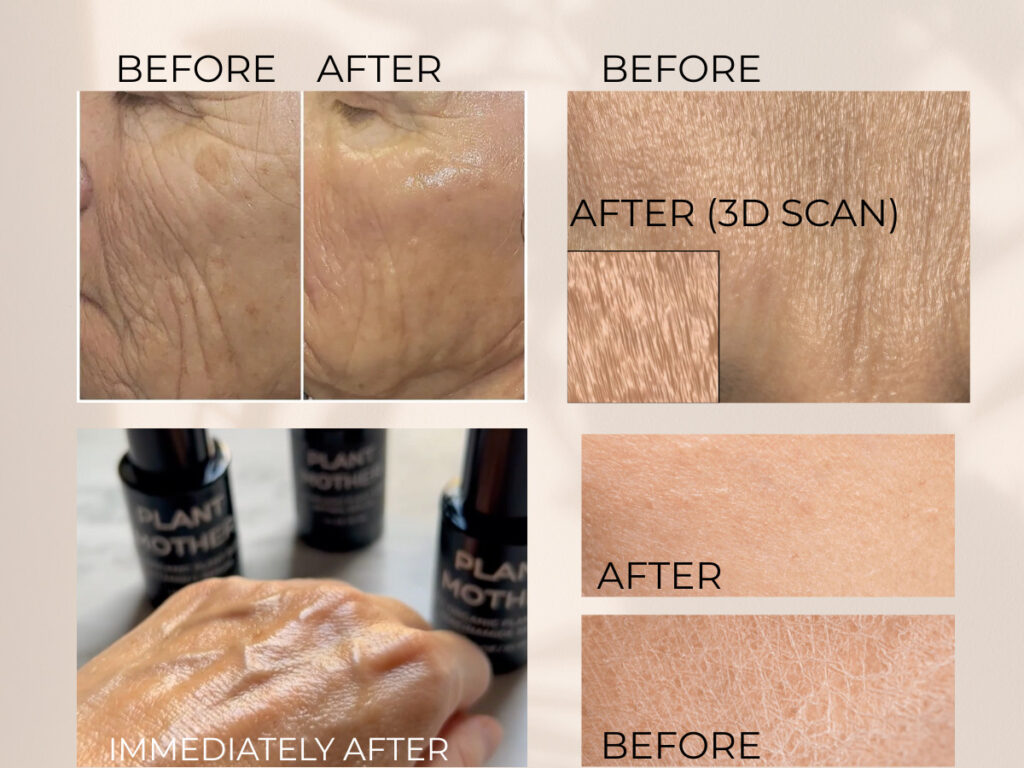 serums before after